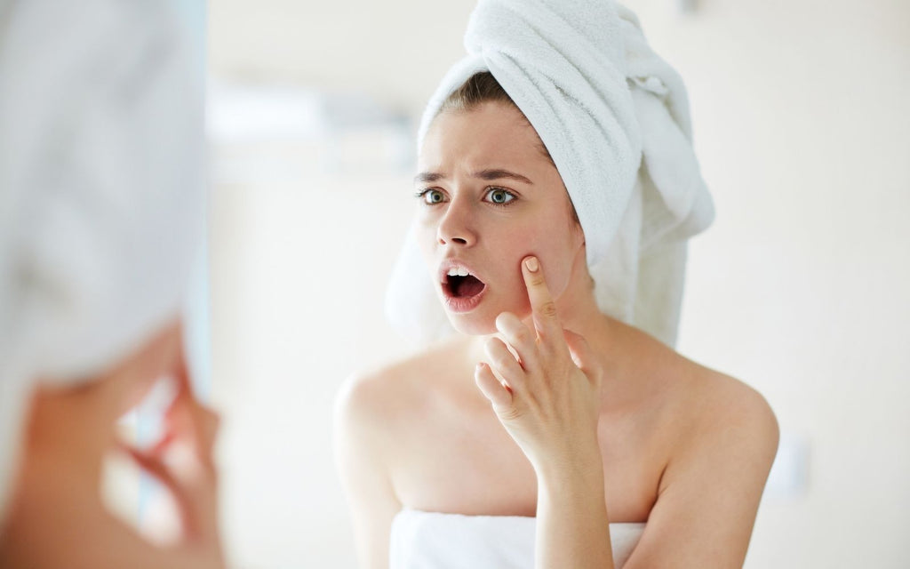 Which Type Of Acne Do You Have?