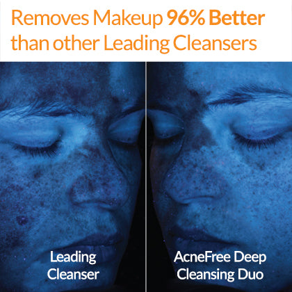 Advanced Deep Cleansing Brush