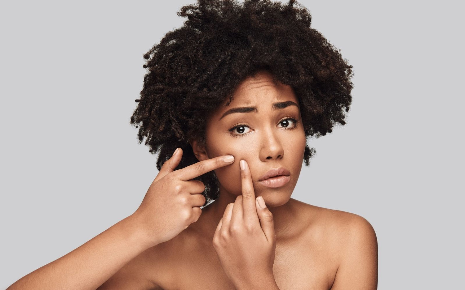Teenage Acne Tips From Board-Certified Dermatologist