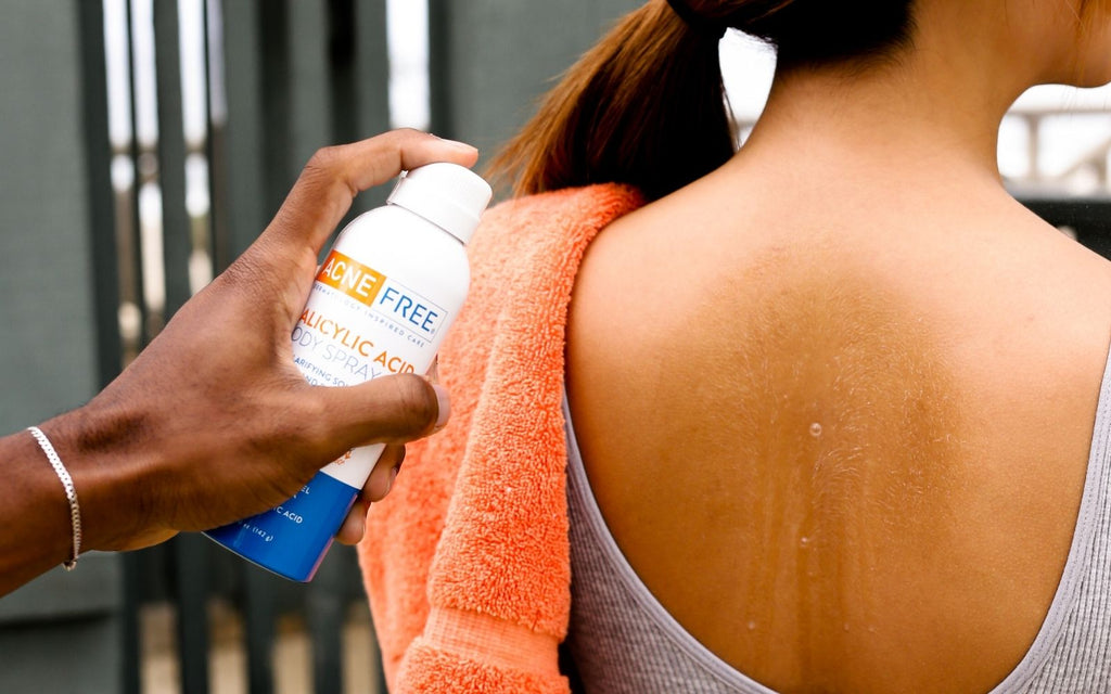 Everything You Want To Know About Back Acne